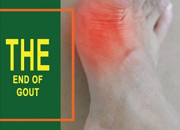 The End of Gout Reviews: Shelly Manning’s Program Effective?