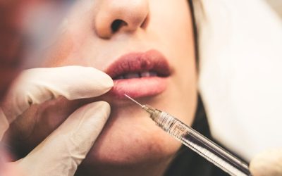 How long does Botox take to work?