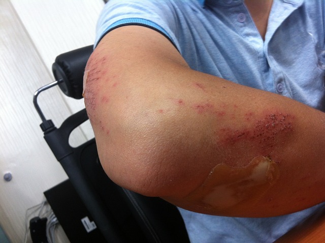 What You Need to Know About Workers’ Compensation in Arizona
