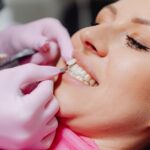 Porcelain Veneers: A Complete Guide to a Natural-Looking, Long-Lasting Smile