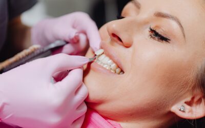 Porcelain Veneers: A Complete Guide to a Natural-Looking, Long-Lasting Smile