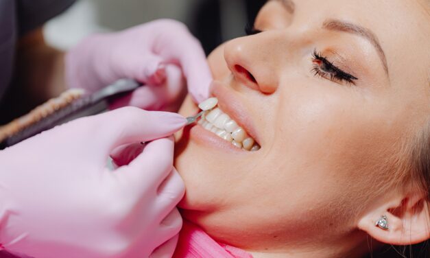 Porcelain Veneers: A Complete Guide to a Natural-Looking, Long-Lasting Smile
